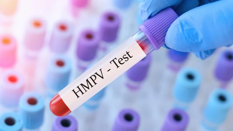 Що таке HMPV (метапневмовірус людини)? Симптоми та лікування